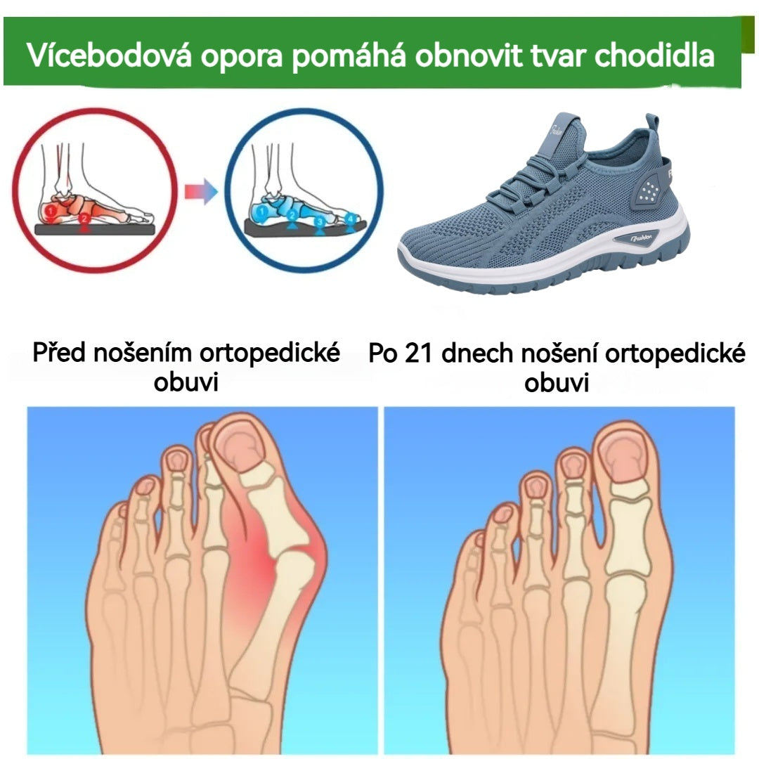 🔥 50% de descuento hoy - ¡no te lo pierdas! ⏰ Zapatos ortopédicos de diseño ergonómico con soporte para el arco👞 Alivia fácilmente el dolor de pie ✅Cómodo y transpirable
