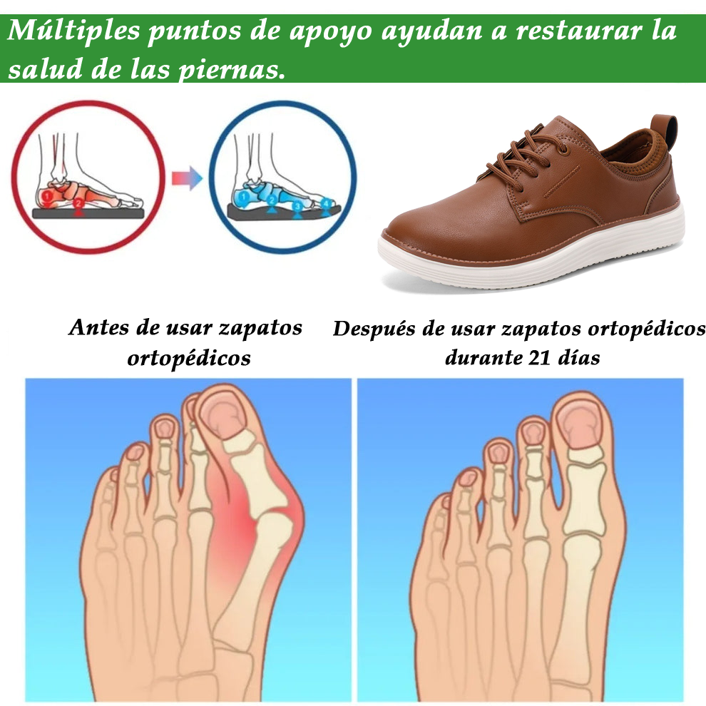 (🔥¡50% DTO. por tiempo limitado!) - Zapatos ortopédicos ASSNAS® de piel auténtica, cómodos y elegantes 👞 (impermeables, antideslizantes, soporte de arco, pisada suave)