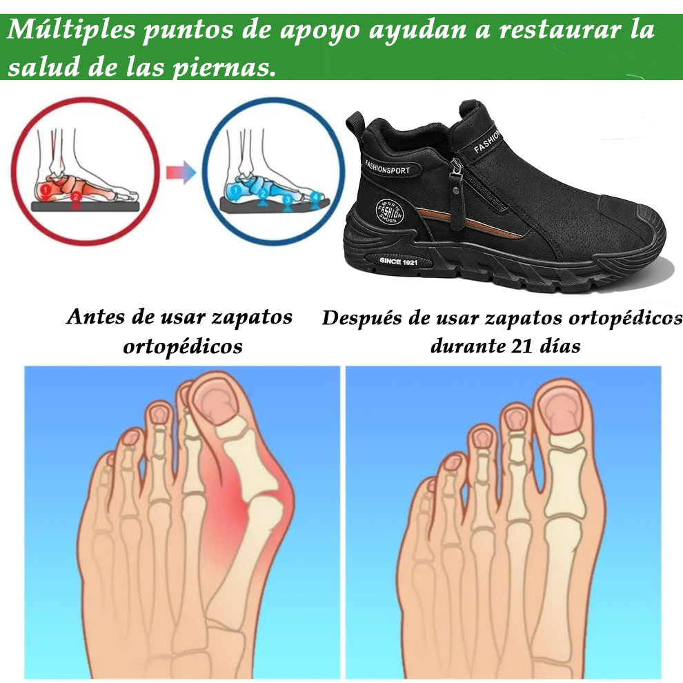 50 % de descuento por tiempo limitado | Zapatos ortopédicos Optimumto® | Cómodos y antideslizantes ✅ Soporte de arco para caminar cómodamente